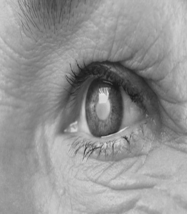 cataract-new